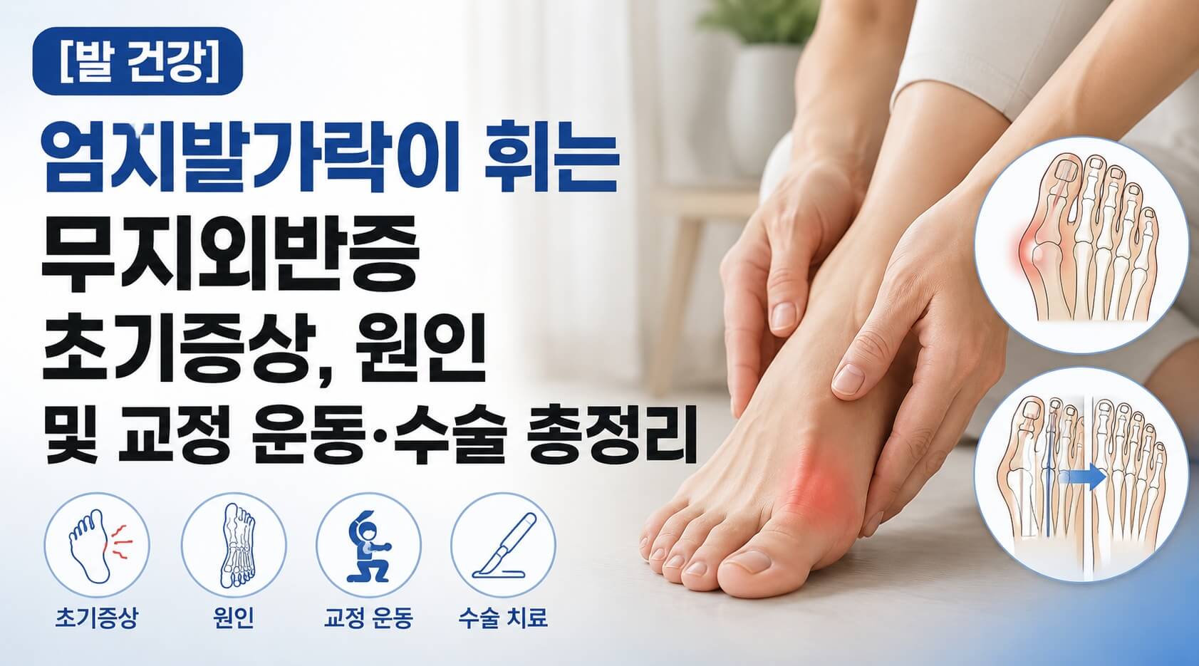 무지외반증 메인사진