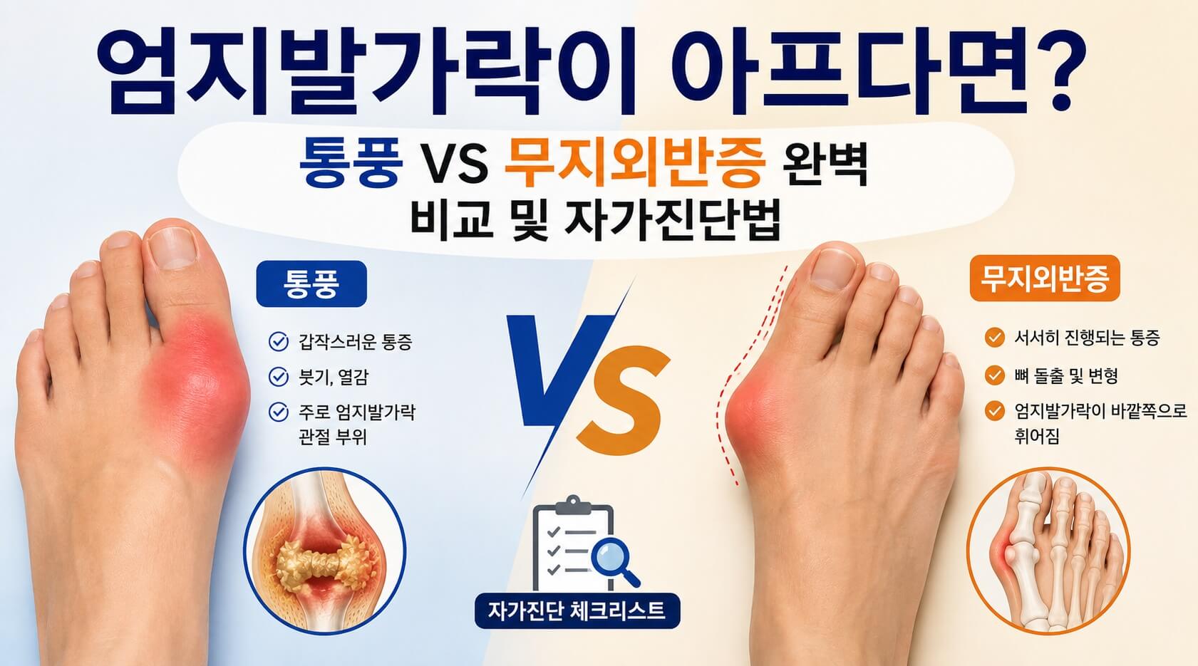 통증, 무지외반증 비교 사진