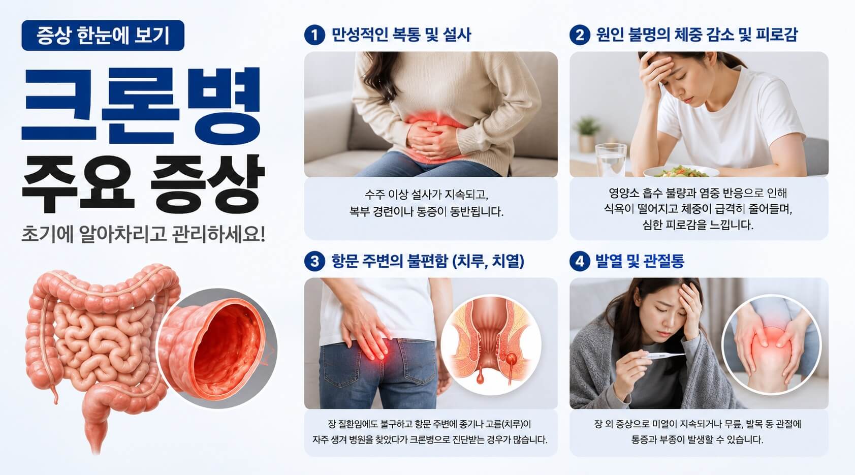 크론병 주요증상