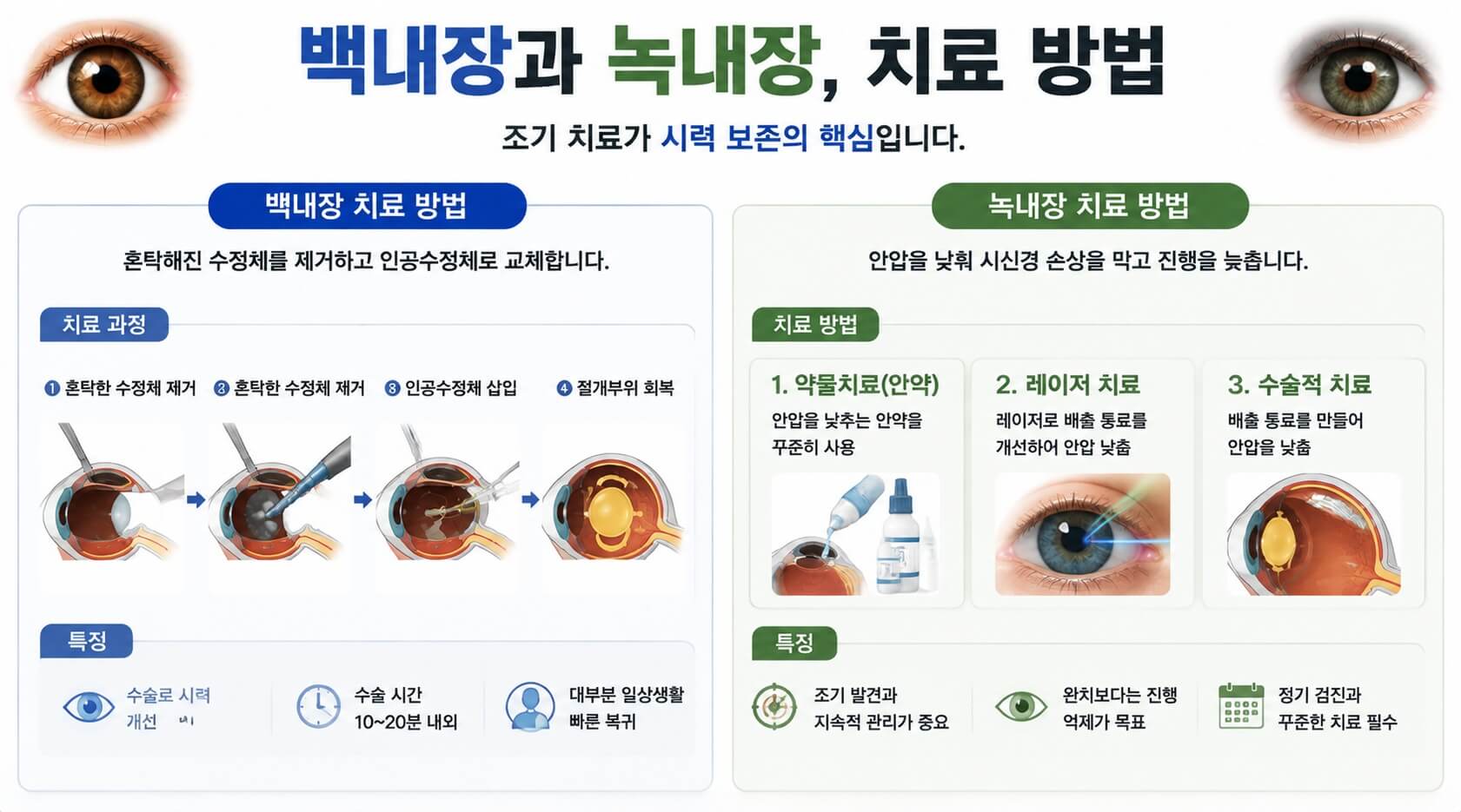 백내장 녹내장 치료
